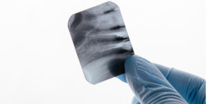 Análisis de radiografía periapical: cómo se hace en 12 pasos y cómo se analiza este tipo de examen