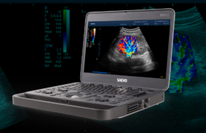 Evus 5: Descubriendo a los Beneficios del Ultrasonido Médico en la Odontología
